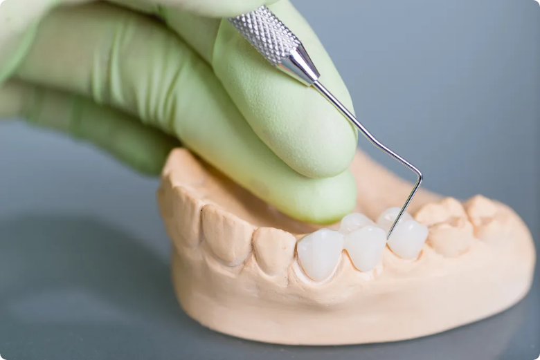 Common Myths About Dental Crowns Debunked