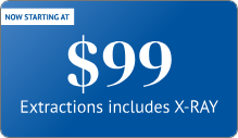 Star Dental Offers Extractions, Which Include X-RAY